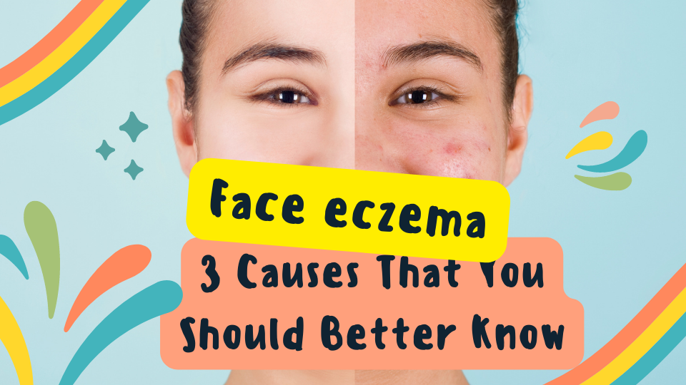 face eczema